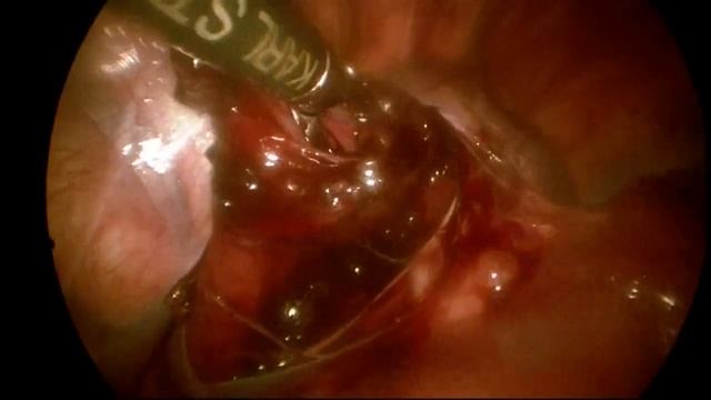 Гринева справа.mp4