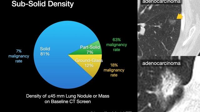 Distinguish Malignant vs. Benign Lung Nodules смотреть онлайн