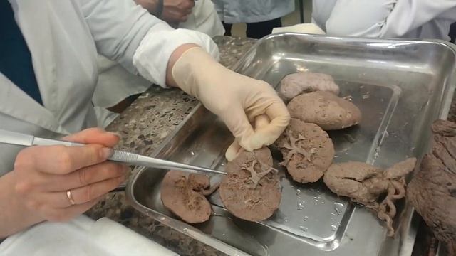 Анатомия | Почки смотреть онлайн