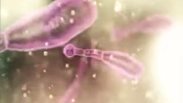 Моя ужасная счастливая история. Эхинококкоз смотреть онлайн