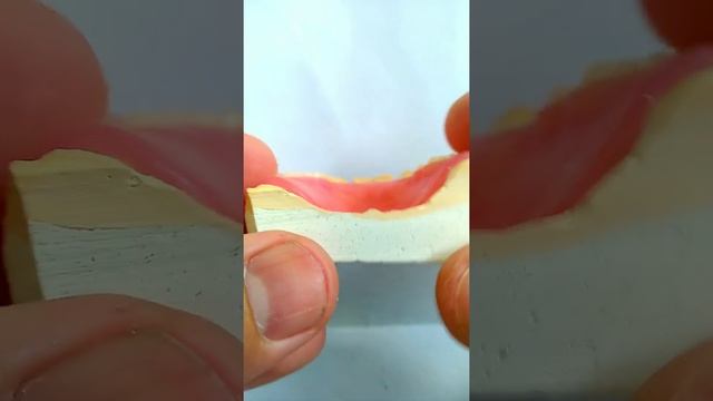 Нейлоновый протез! смотреть онлайн