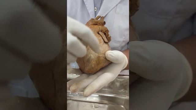 Exterior of the Heart(Raw version) смотреть онлайн