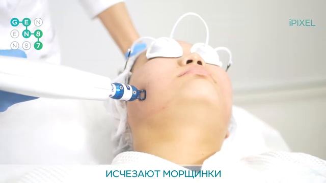 ФРАКЦИОННАЯ АБЛЯТИВНАЯ ШЛИФОВКА ЛИЦА iPixel (АйПиксель) Сеть клиник косметологии GEN87(2) смотреть онлайн