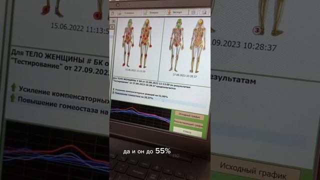 Анализ состояния здоровья на аппаратно-программном комплексе «Dianel ® Pro». ЦИОТ 