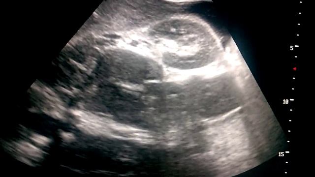 Физическое преображение