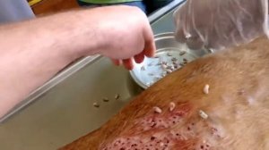 Жесть! Огромное количество подкожных паразитов!