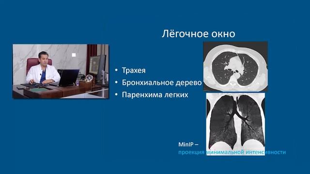 Грудная клетка. Радиологическая анатомия. Лекция 1. смотреть онлайн
