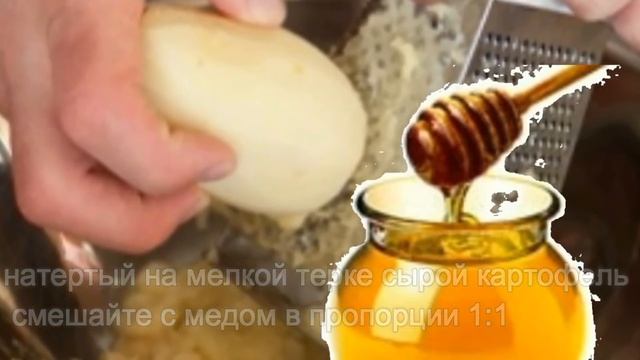 УБИРАЕМ ОТЛОЖЕНИЯ СОЛЕЙ НА ШЕЕ. Остеохондроз шейного отдела воротниковой зоны. смотреть онлайн