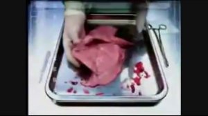 Вред от курения, курение вредит здоровью, последствия курения, пассивное курение