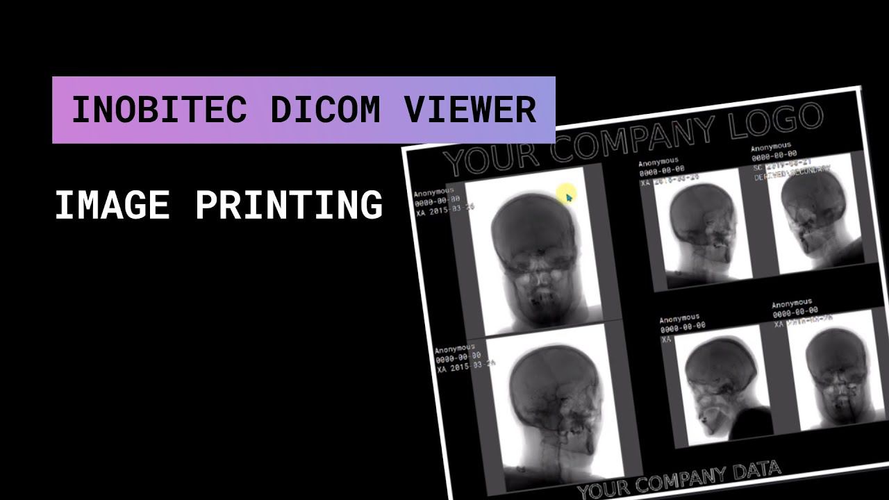Печать изображений в Inobitec DICOM Viewer смотреть онлайн