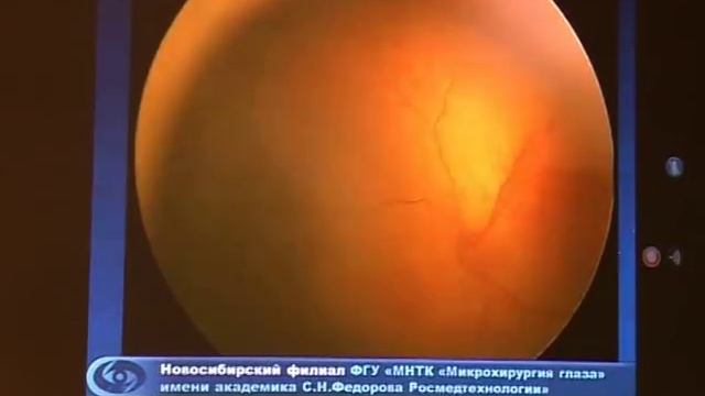 Гимн Калужского филиала МНТК смотреть онлайн