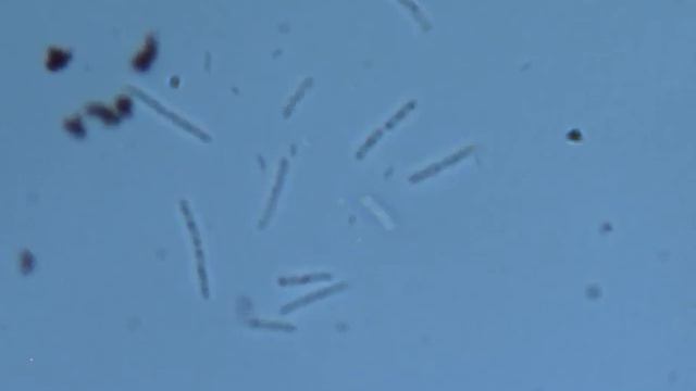 bacteria mikroskop смотреть онлайн