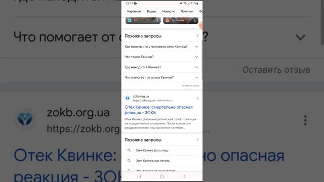 гугл думает что квинка болезнь так и есть смотреть онлайн