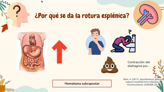 MONONUCLEOSIS INFECCIOSA смотреть онлайн