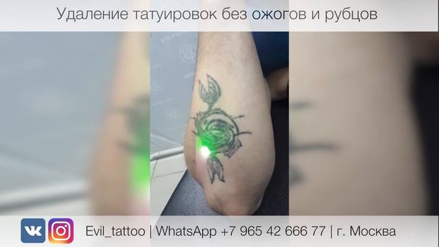 Лазерное удаление татуировки в студии Evil Tattoo. Без травм, ожогов и рубцов. смотреть онлайн