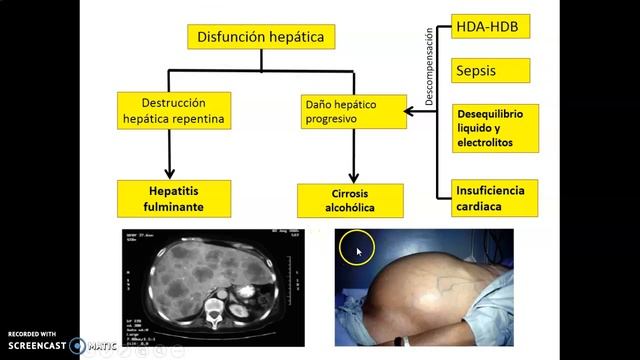 FSPTA 2022. Insuficiencia hepatica .Parte1. смотреть онлайн