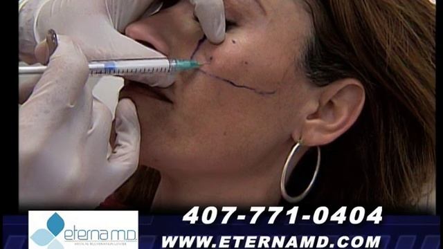 RADIESSE VIDEO смотреть онлайн