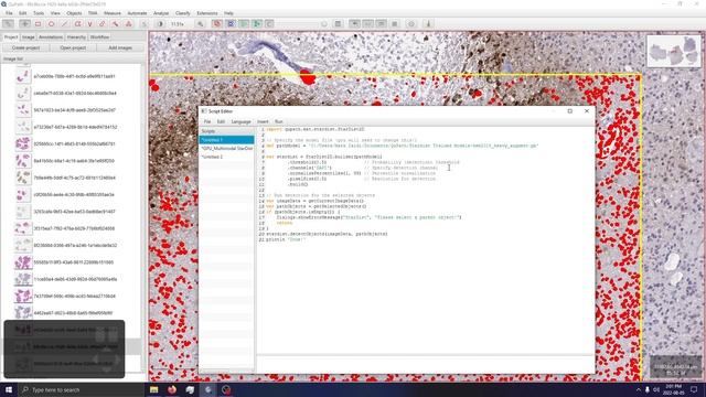HDAB Cell Detection using StarDist in QuPath смотреть онлайн