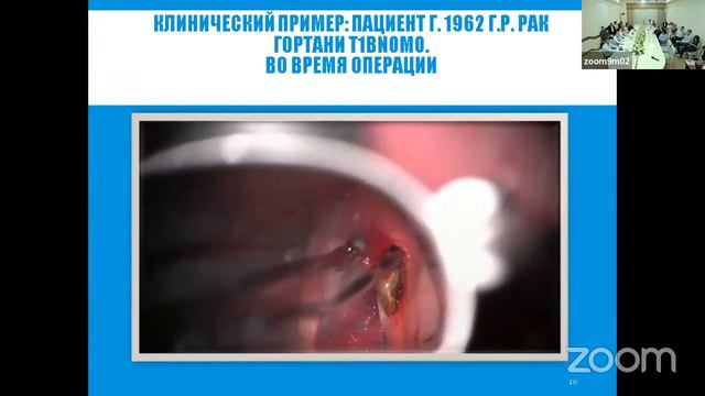 СЕКЦИЯ 8. Опухоли головы и шеи, нейроонкология смотреть онлайн