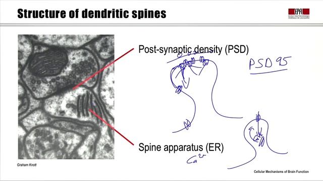 4.5 Dendritic spines смотреть онлайн