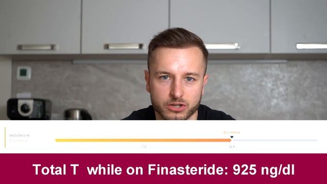 4 Months after Oral Finasteride! UPDATE смотреть онлайн