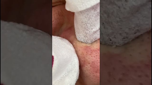 Чистая кожа, придает здоровый вид. Это факт‼️ #увлажнениекожи смотреть онлайн