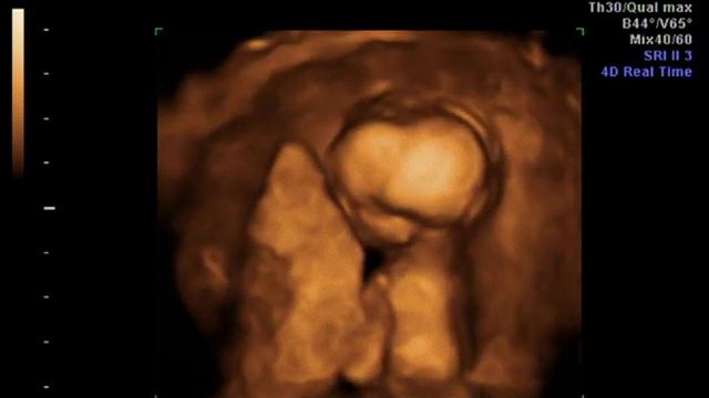 Baby Edwards Ultrasound.... It's a Boy ! смотреть онлайн