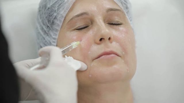 RRS HA Long Lasting - biorevitalizare și volumetrie facială смотреть онлайн