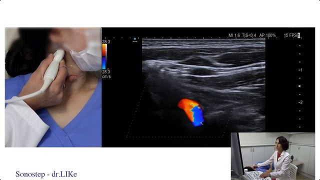 Вебинар - ультразвуковая диагностика артерий шеи