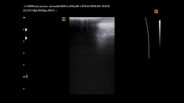 Видео - задача (снято 29-6-17) смотреть онлайн