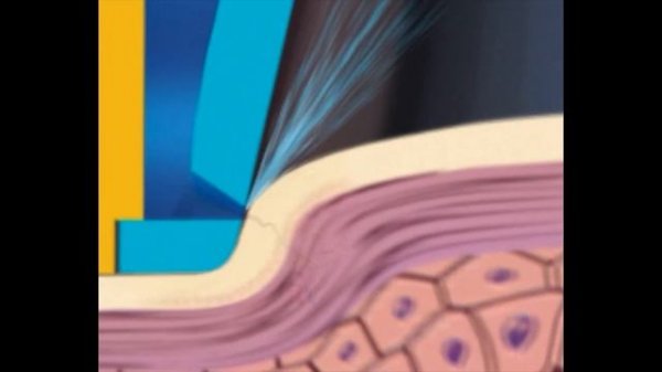 Аппарат  "Affinity"