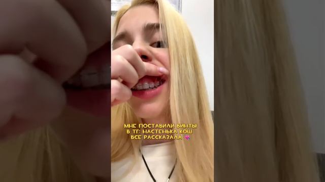 КОГДА ТЕБЕ ПОСТАВЯТ БРЕКЕТЫ… смотреть онлайн