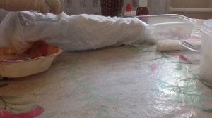 перевязка гнойных ран