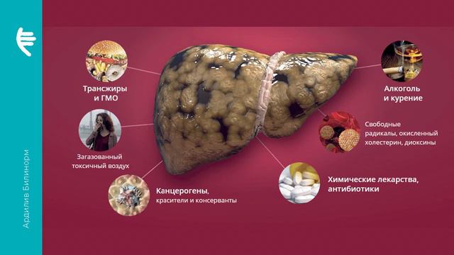 Комплекс «Ардилив» и «Билинорм»  Эффективная защита вашей печени