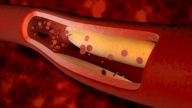 ანწლი წამალი და საწამლავი I რეცეპტები смотреть онлайн