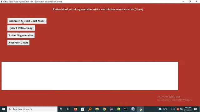 Retina blood vessel segmentation with a convolution neural network U net _ Python смотреть онлайн