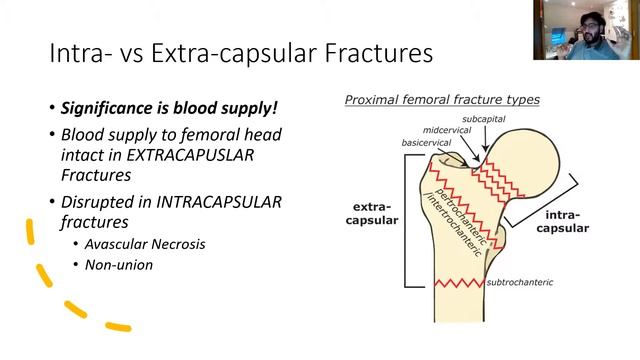 Trauma & Orthopaedics by Dr Danny Chandia | British Indian Surgical Association) смотреть онлайн