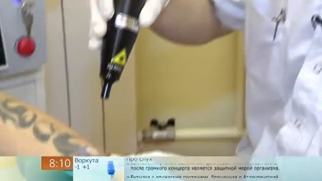 pro udalenie tatuirovok 2013 смотреть онлайн