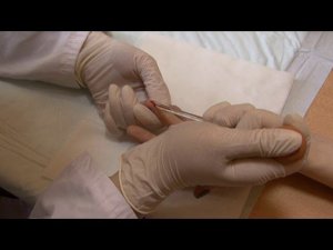 Подсчет количества лейкоцитов