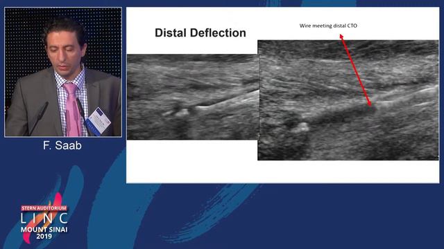 Stern D2 - Primary Pedal Access for CLI: Is it Ready for Prime Time? - Dr. Fadi Saab смотреть онлайн
