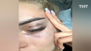 Дом-2: Катя Скалон пострадала от рук Влада Иванова