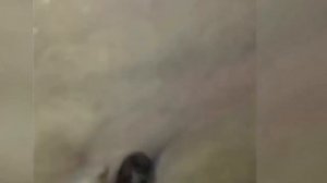 ТОП самых больших прыщей