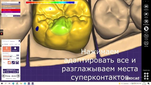 ExoCad моделировка 46 зуба смотреть онлайн