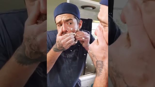 Парень давил прыщ… И вот что получилось смотреть онлайн