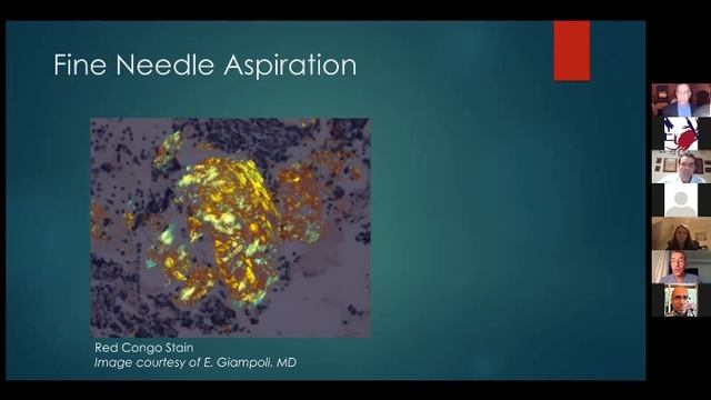 AHNS Virtual Tumor Board: Thyroid: Good, Bad, Ugly смотреть онлайн