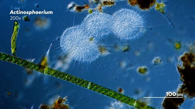 Heliozoa: Round, Sticky, and Covered in Spikes смотреть онлайн