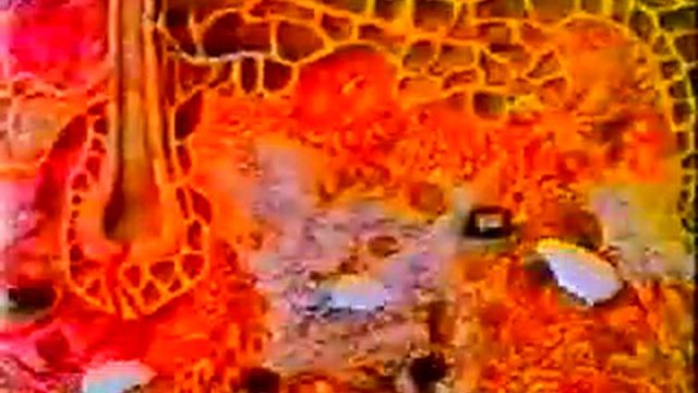 Лимфоциты VS Онкоклетки. РАК ПОБЕДИМ! смотреть онлайн