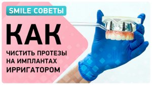 Гигиена протезов на имплантах ? как пользоваться ирригатором