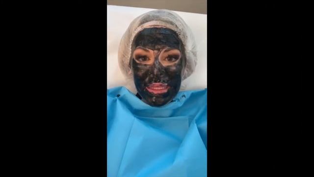 Carbon peeling - Testimonianza e risultati смотреть онлайн