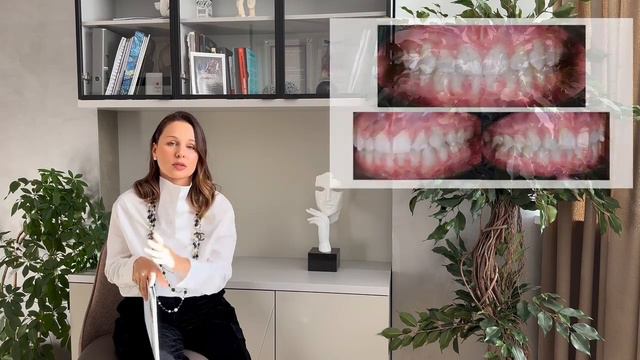 Влюбляю в изгибы ортодонтической дуги смотреть онлайн